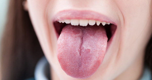 5 biểu hiện ở lưỡi cho thấy cơ thể đang có bệnh, nếu không có cái nào chứng tỏ bạn đang rất khỏe mạnh