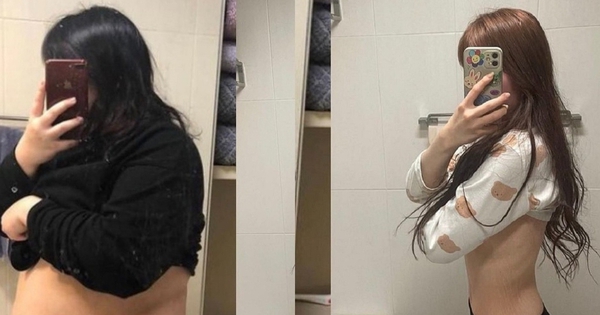 Trầm cảm vì nặng 124kg, cô gái Hàn Quốc chia sẻ cách giảm 75kg và cái giá phải trả khi giảm cân tiêu cực