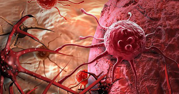 Tế bào ung thư mạnh hơn tế bào thường: 5 sai lầm có thể ảnh hưởng tính mạng người bệnh