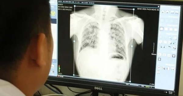 Bụi phổi khiến nhiều công nhân tử vong ở Nghệ An: Căn bệnh nghề nghiệp để lại nhiều di chứng nặng nề cho người lao động