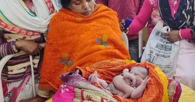Em bé Ấn Độ chào đời có 4 chân, 4 tay, dân chúng bỗng ào ào đến thờ cúng
