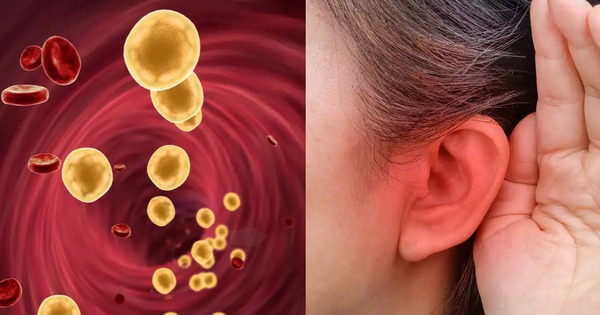 Khi mỡ máu tăng cao, tai sẽ phát ra 3 "tín hiệu" cảnh báo đỏ
