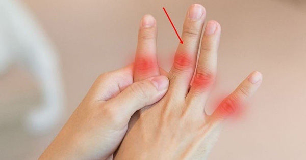 3 đặc điểm ở ngón tay giữa ngầm cảnh báo gan của bạn đã bị tổn thương, giơ tay lên xem luôn nào!