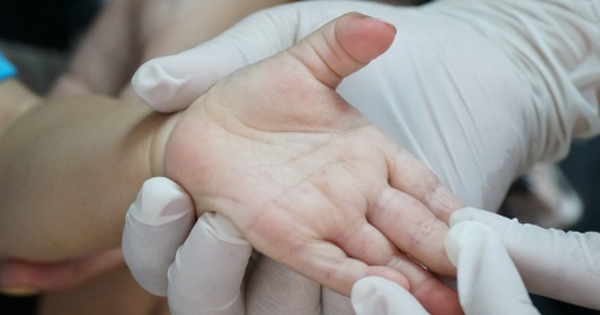 Một bệnh nhi ở Đắk Lắk tử vong vì tay chân miệng