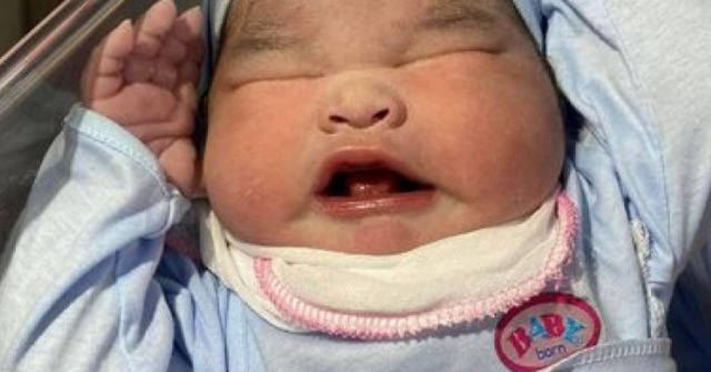 Em bé nặng 5,1kg vừa chào đời bằng phương pháp đẻ thường trước sự bất ngờ của ê-kíp bác sĩ