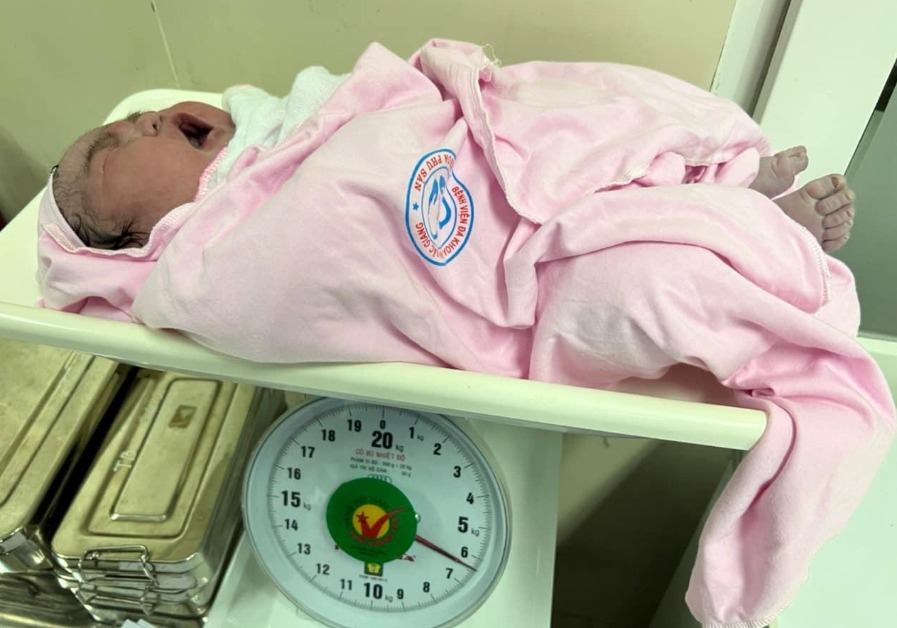 Bé gái ở Bắc Giang chào đời nặng 6,2kg, nặng bằng trẻ 2-3 tháng tuổi